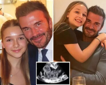 David Beckham’s 17-Year