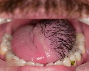 These are the consequences of eating …See more