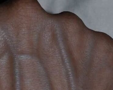 If you have these visible veins in your hand it’s a sign of can…See more – Notebook 2025 If you have these visible veins in your hand it’s a sign of can…See more – Notebook 2025