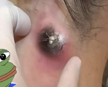 What Can Happen to Your Body If What Can Happen to Your Body If