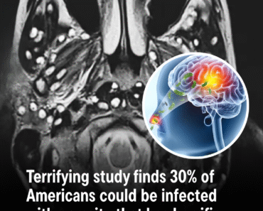 A study has revealed how up to 30% of Americans could be infected with a dangerous parasite