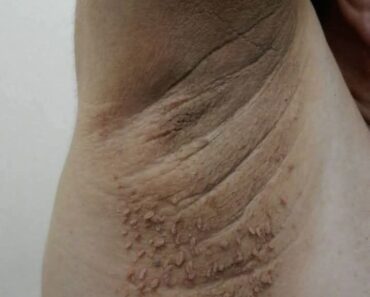 HT10. These are the first symptoms of cr…See more – Daily News