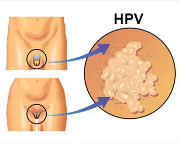 These are the consequences of sleeping with…See more – Daily News – Daily News