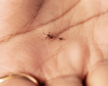 Invasive ticks have scientists spooked about new diseases