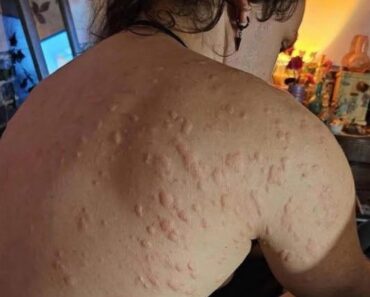 HT13. These are the consequences of sleeping with…see more – Daily News