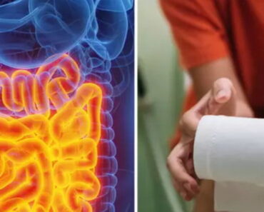 Doctor says certain type of poo is a ‘highly concerning’ red flag for ca.n.cer