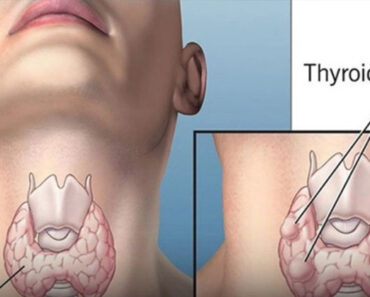 Wa.rning: These 2 Supplements Could Accelerate Thyroid Ca.ncer
