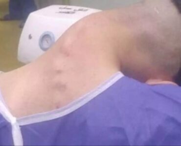 HT13. Young man hospitalized because he dropped his ca…See more – Daily News