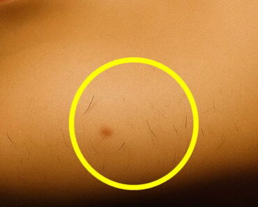 If you’re a woman with chin whiskers, pay attention If you’re a woman with chin whiskers, pay attention