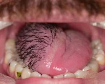 HT10. These are the consequences of eating cr… See more