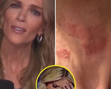 Megyn Kelly Hospitalized in Critical C