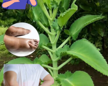 Kalanchoe – If you have this plant, you’ve got a treasure and didn’t even know it. To keep receiving my recipes, check 1st commen Kalanchoe – If you have this plant, you’ve got a treasure and didn’t even know it. To keep receiving my recipes, check 1st commen