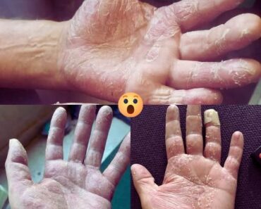 These are the signs that he is cr… Read full article in first comment