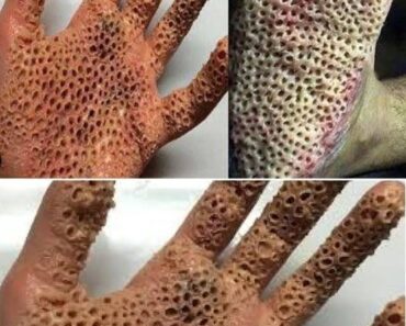 These are the consequences of sleeping with…See More These are the consequences of sleeping with…See More