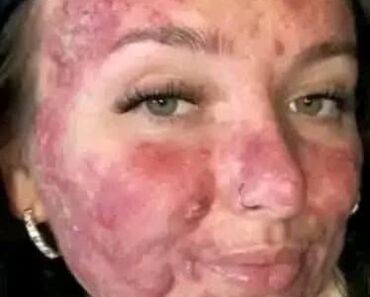 Her body was itchy, he thought it was an allergy, they diagnosed him with ca…see more – Daily News Her body was itchy, he thought it was an allergy, they diagnosed him with ca…see more – Daily News