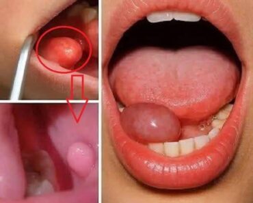 These are the first symptoms of a… See more These are the first symptoms of a… See more