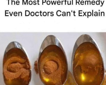 Cinnamon and Honey: The Most Powerful Remedy Even Doctors Can’t Explain Cinnamon and Honey: The Most Powerful Remedy Even Doctors Can’t Explain