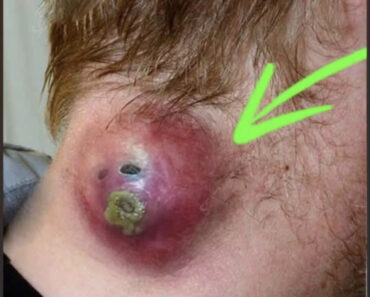 Seven Things That Clog Your Pores