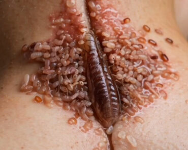 Crucial Techniques for Preventing Infections in Your.. Crucial Techniques for Preventing Infections in Your..