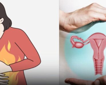 Diet and Lifestyle Choices to Help Prevent Ovarian Can:cer