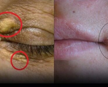 4 Subtle Signs on Your Face That Could Signal Health Problems