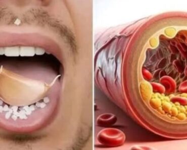 Did you know that if you consume raw garlic daily…