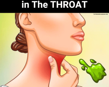 The Real Causes of Constant Phlegm and Mucus in Your Throat – How to Get Rid of It The Real Causes of Constant Phlegm and Mucus in Your Throat – How to Get Rid of It