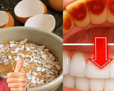 Brighten Your Smile with Simple Ingredients