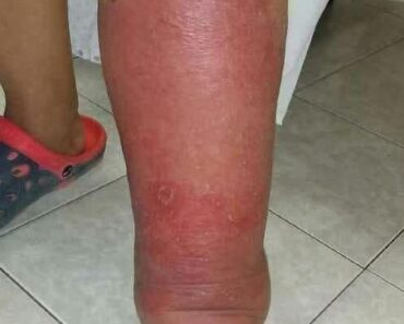 These Are Clear Signs That He Is Cr…See more – Daily News