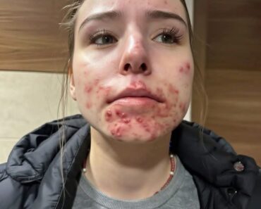 These are the consequences of sleeping with a… See more