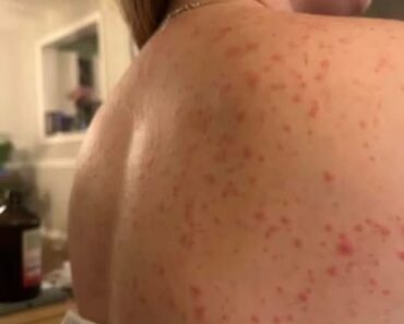 These are the consequences of sleeping with the…See more These are the consequences of sleeping with the…See more