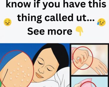 See more in 1st comment See more in 1st comment