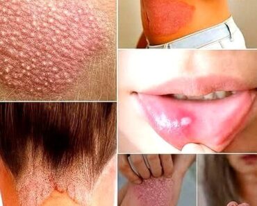 Signs You Should Know If You Have This Thing Called Da…