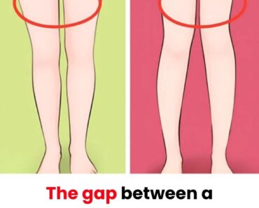 What Does the Thigh Gap Say About Your Diet?