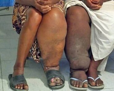 These are the consequences of slee