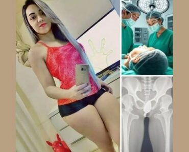 HT13. Girl was hospitalized for trying a…See more HT13. Girl was hospitalized for trying a…See more
