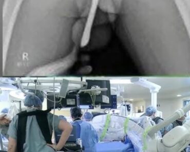 HT13. Girl had to be hospitalized for wanting to use a pe…See more – Daily News