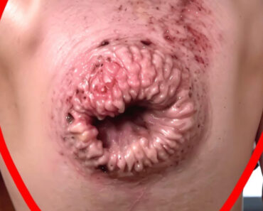 Important: Crucial Techniques for Preventing Infections in Your Eyes