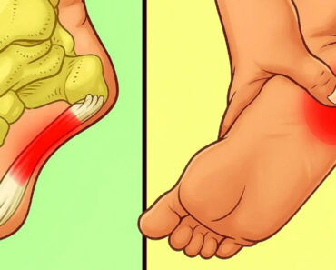 7 Powerful Exercises to Relieve Heel Pain and Treat Plantar Fasciitis Naturally 7 Powerful Exercises to Relieve Heel Pain and Treat Plantar Fasciitis Naturally