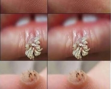 BE VERY CAREFUL . If you get this, you are infected with…See more