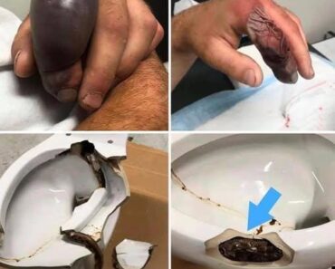 HT15. In several regions, while using their toilets, people were attacked by…See more