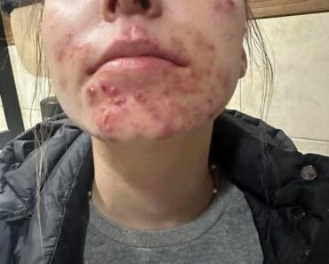 His body was itchy, he thought