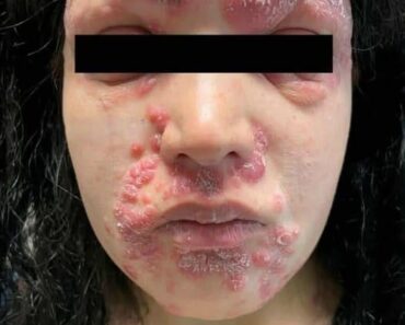 HT13. These are the consequences of sleeping co… See more HT13. These are the consequences of sleeping co… See more