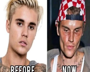 Justin Bieber admits that he tested positive for…See More