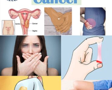 12 Warning Signs Your Uterus Is Crying for Help – Don’t Ignore These Symptoms 12 Warning Signs Your Uterus Is Crying for Help – Don’t Ignore These Symptoms