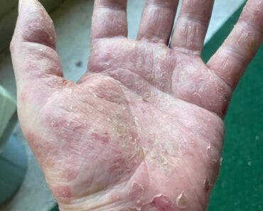 These are the signs that he is cr…See more