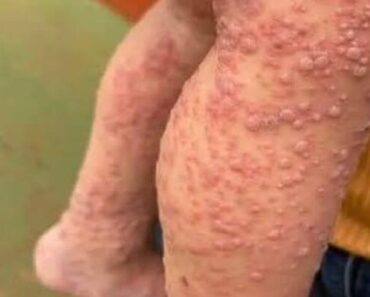 These are the signs that he is cr…See more – Daily News These are the signs that he is cr…See more – Daily News