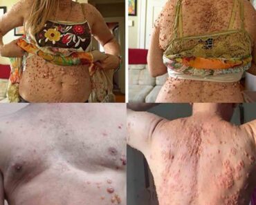 A Comprehensive Guide to Genital Bumps, Sores, A Comprehensive Guide to Genital Bumps, Sores,