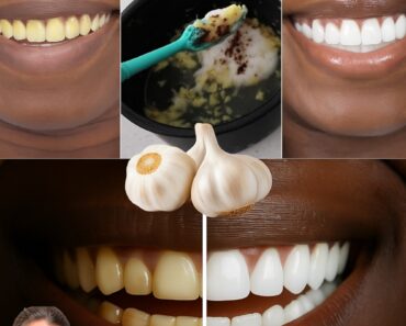 Unlock a Dazzling Smile in Just 2 Minutes: Erase 10 Years of Stains with This Kitchen Secret That Will Leave You Speechless! Unlock a Dazzling Smile in Just 2 Minutes: Erase 10 Years of Stains with This Kitchen Secret That Will Leave You Speechless!