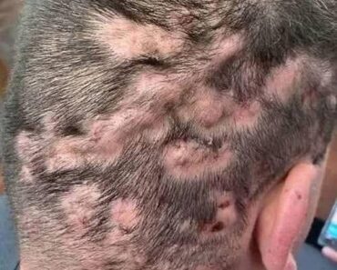 Early warning signs: signs that y Early warning signs: signs that y